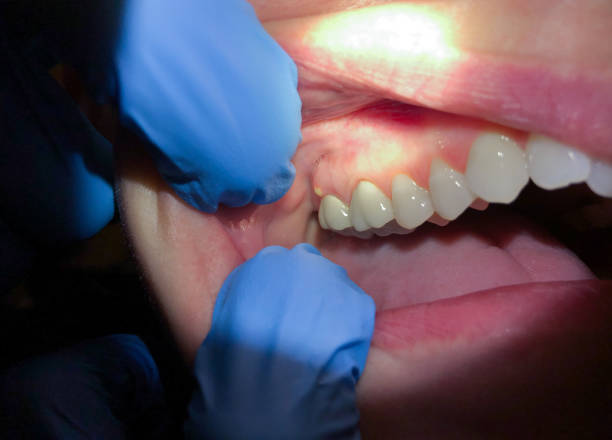 Professional Emergency Dental Service in KY