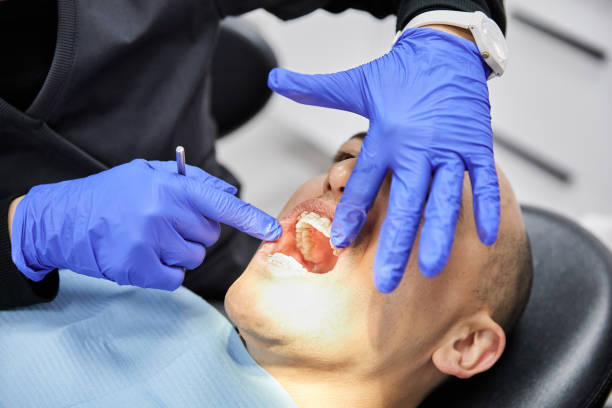 Best Emergency Wisdom Tooth Extraction in Cadiz, KY
